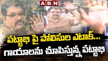 పట్టాభి పై పోలిసుల ఎటాక్... || గాయాలను చూపిస్తున్న పట్టాభి || TDP Pattabhiram Moved To Court  | ABN