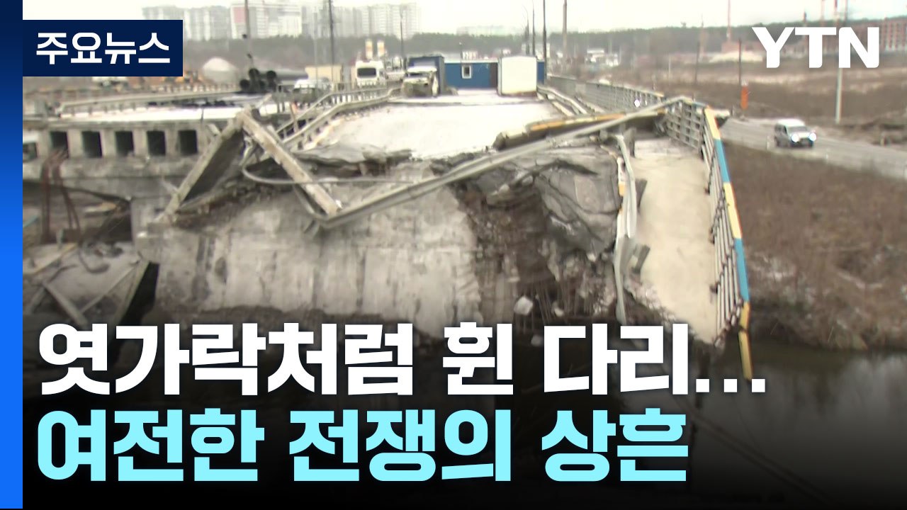엿가락처럼 휜 다리...여전한 전쟁의 상흔 / YTN