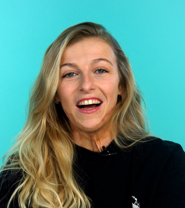 L'incroyable parcours de Julie, brûlée sur 40 % du corps au 3e degré