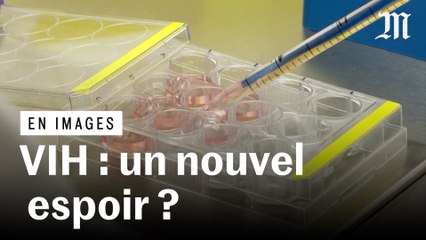 En images : la recherche encouragée par la guérison d’un patient atteint du VIH
