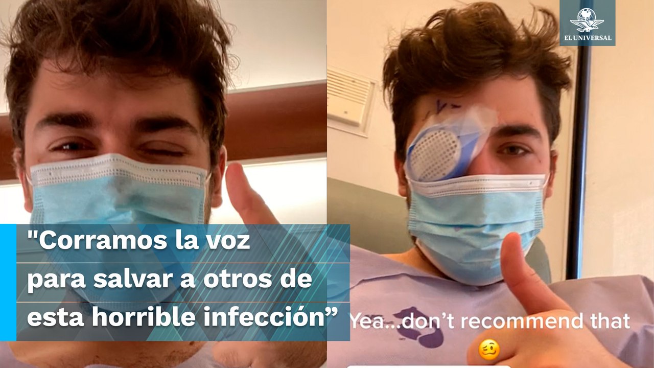 "Parásitos se comieron mi ojo": Se queda ciego por tomar siesta con lentes de contacto