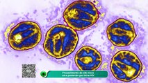 Procedimento de alto risco cura paciente que tinha HIV