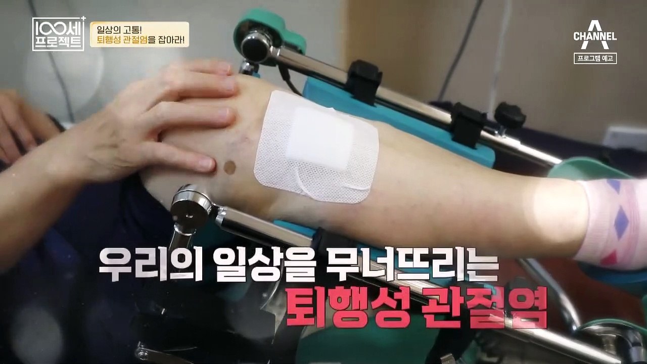 [예고] 참기 힘든 고통! 퇴행성 관절염을 잡아라