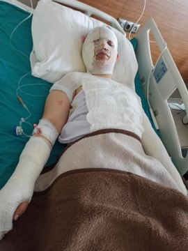 DEPREMZEDE ESKİ EŞİNİ KAYNAR SUYLA YAKTI; 'ARTÇI SARSINTI NEDENİYLE OLDU' DEDİ