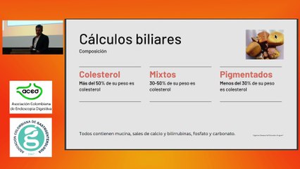 Tratamiento de la enfermedad  asociada a cálculos. Dr. Benedicto Velasco Sepúlveda.