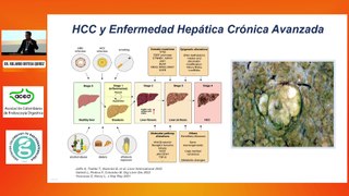 Hepatocarcinoma.   Dr. Rolando Ortega Quiroz.
