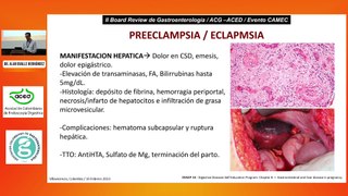 Enfermedades hepáticas del embarazo  Dr Alan Ovalle