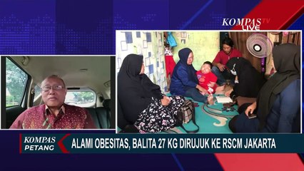Balita Obesitas Seberat 27 Kilogram, Bagaimanakah Penanganan untuk Kenzi?