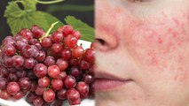 Red Grapes खाने से क्या होता है | लाल अंगूर खाने के फायदे | Boldsky *health