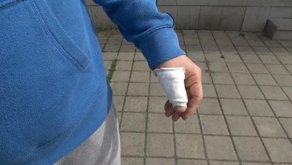 ARNAVUTKÖY'DE SOKAK KÖPEKLERİ ÇOCUKLARA SALDIRDI