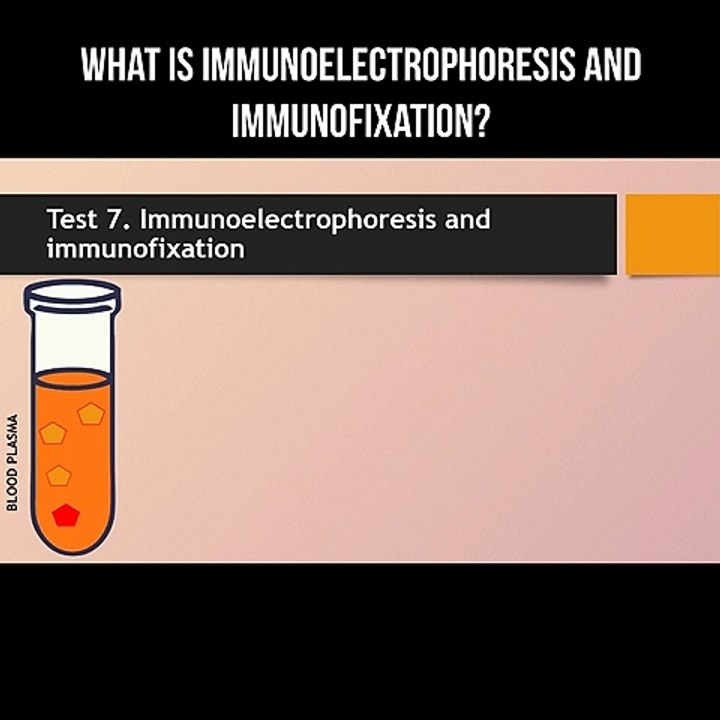 what-is-immunoelectrophoresis-and-immunofixation-video-dailymotion