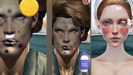 ASMR Remove unmanaged piercing pus animation | Squeeze hear and face acne