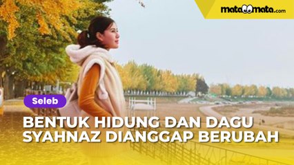 Syahnaz Sadiqah Posting Foto Selfie, Bentuk Hidung dan Dagu Dianggap Berubah