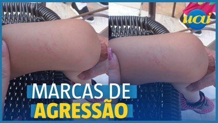 Mãe denuncia agressão à filha com autismo em Emei de BH