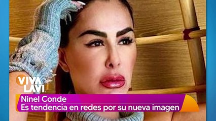 Ninel Conde PREOCUPA a sus fans por la apariencia de su rostro