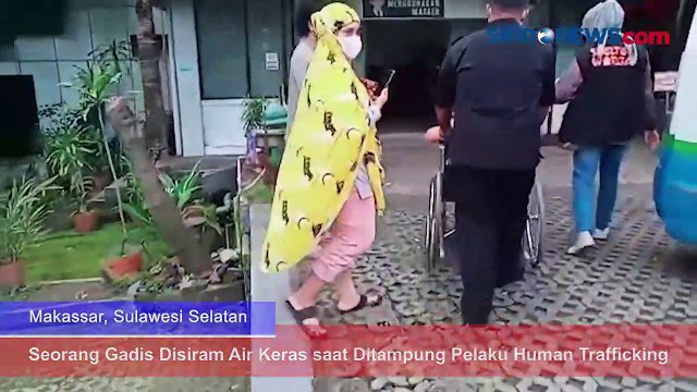 Seorang Gadis di Makassar Disiram Air Keras aaat Ditampung Pelaku Human Trafficking