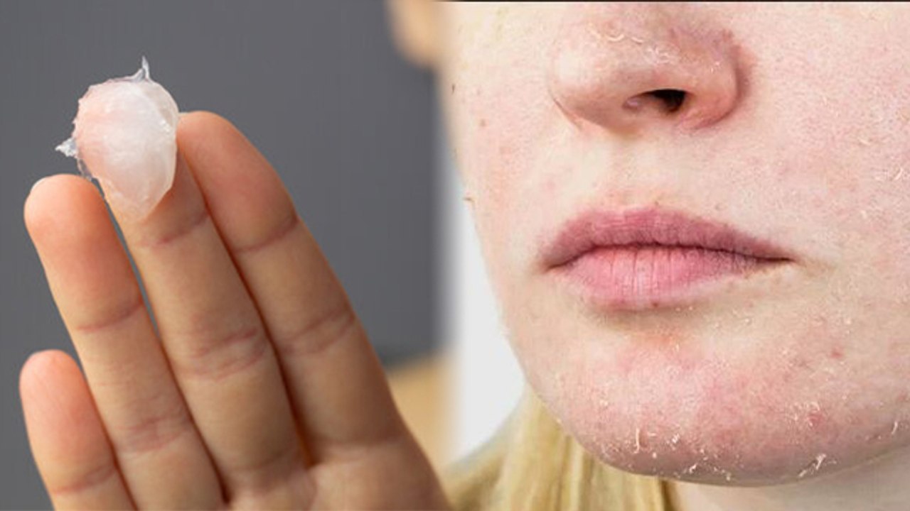 Coconut Oil Or Petroleum Jelly Dry Skin के लिए क्या है ज्यादा