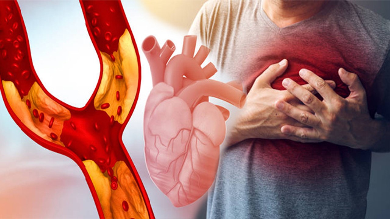 Coronary Artery Disease कब और क्यों होती है , किन लोगो को ज्यादा खतरा |Boldsky