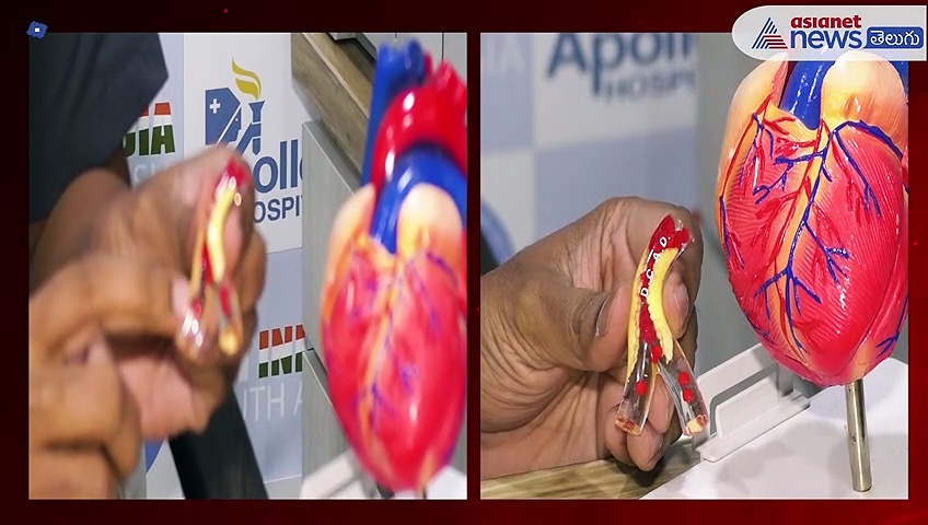 యువతలో హార్ట్ అటాక్స్... ప్రధాన కారణాలు, తీసుకోవాల్సిన జాగ్రత్తలు