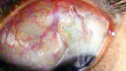 10 Parasitic Animals That Will Give You The Chills