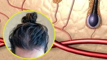 Hair में Sweating होना Hyperhidrosis Symptoms, क्या है Reason |Boldsky
