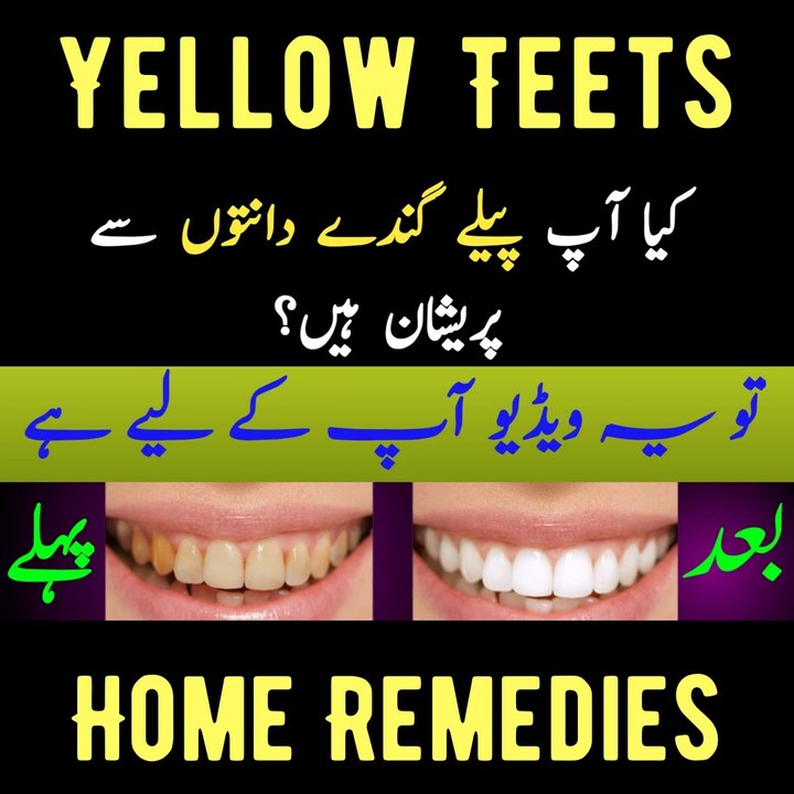 How to Whiten Teeth Naturally with 5 Simple Home Remedies | Teeth Whitening Home Remedies | #Teeth