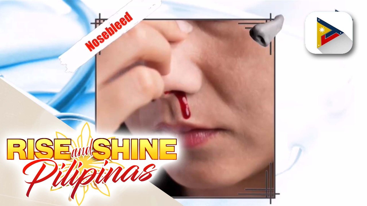 SAY NI DOK | Alamin ang tamang paraan ng pag-handle ng nosebleed at posibleng ugat nito
