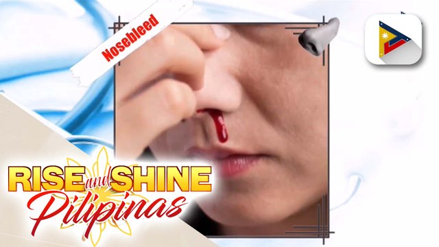 SAY NI DOK | Alamin ang tamang paraan ng pag-handle ng nosebleed at posibleng ugat nito
