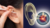 कान की सफाई करनी चाहिए या नहीं | Kaan Ki Safai Karna Chahiye Ya Nahi | Boldsky