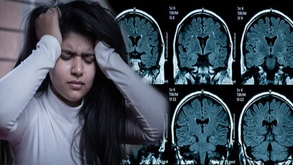 Women में ऐसा Headache होना Hormonal Headache का खतरा ,Reason चौकाने वाला | Boldsky