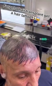 Chauve, il se fait tatouer des cheveux sur le crane