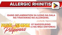 SAY NI DOK | Alamin ang allergic rhinitis
