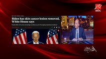 عمرو اديب: البيت الأبيض أعلن أنه تم استئصال ورم سرطاني للرئيس الأمريكي بايدن في فبراير الماضي