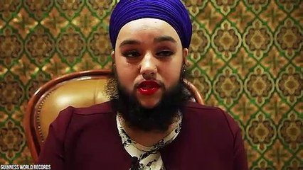 10 Rarest Humans That Are One in A Million (2)