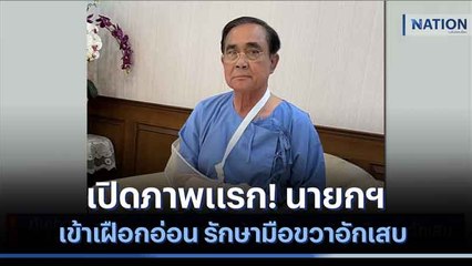 เปิดภาพแรก! นายกฯ เข้าเฝือกอ่อน รักษามือขวาอักเสบ | เนชั่นทันข่าวค่ำ | NationTV22