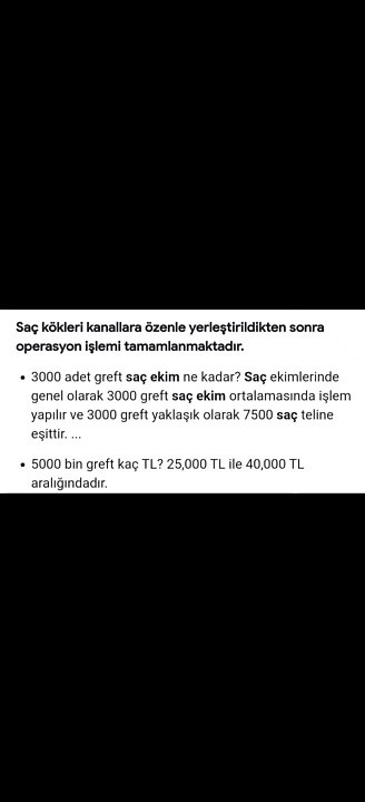 Saç ekimi maliyetli mi? Saç ektirmek ne kadara mal olur?