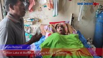 Korban Kecelakaan di Bangka Belitung Koma 2,5 Tahun