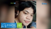 20-anyos na transwoman, sinimulan ang kanyang weight loss journey! | Pinoy MD