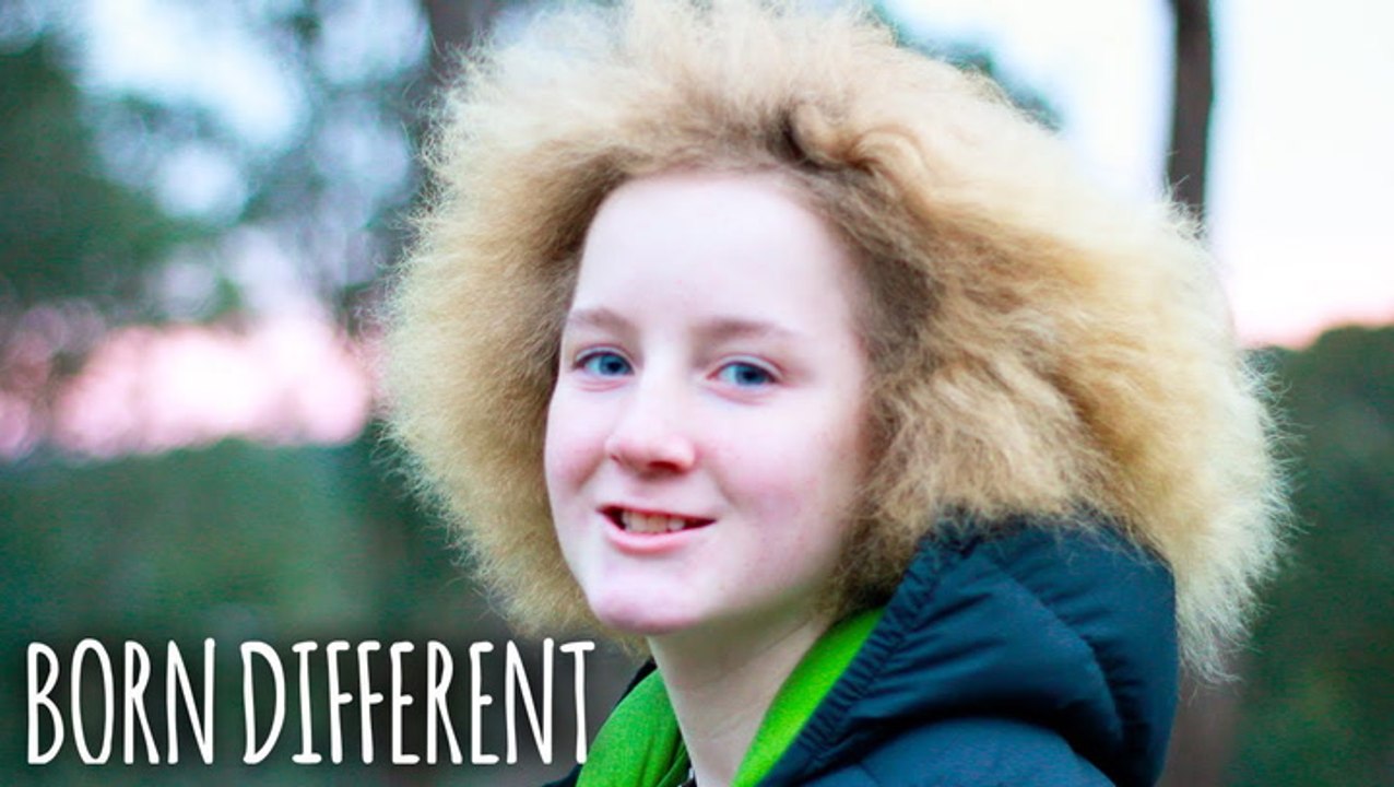 I Have Uncombable Hair Syndrome | BORN DIFFERENT - video Dailymotion
