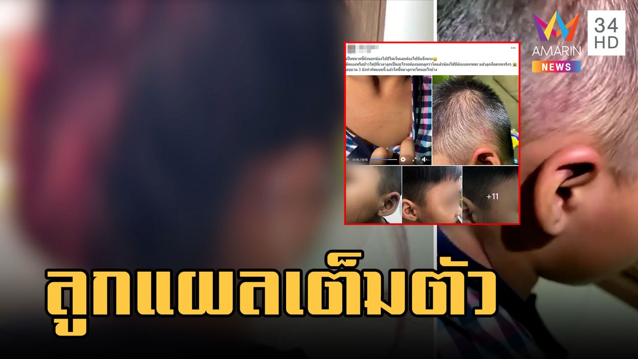 แม่ช็อก! ลูกอนุบาลถูกเพื่อนทำร้าย เอาพลาสติกขูดทั้งตัว | ข่าวเที่ยงอมรินทร์ | 6 มี.ค.66