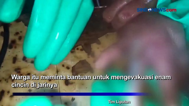 Damkar Pulo Gadung Evakuasi 6 Cincin di Jari Warga yang Bengkak
