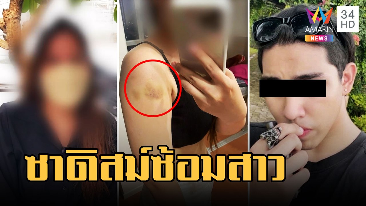 สาวเล่นแอปหาคู่ เจอหนุ่มลูกครึ่งขืนใจซาดิสม์กัดทั้งตัว | ข่าวเที่ยงอมรินทร์ | 7 มี.ค.66