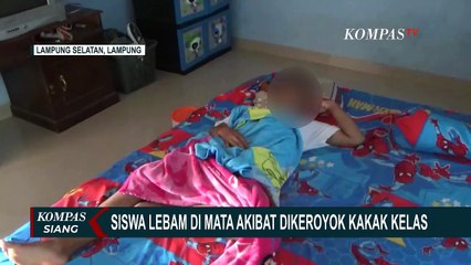 Download Video: Dikeroyok Kakak Kelas, Siswa SMP di Lampung Selatan Alami Luka Lebam