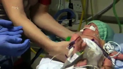 Childrens Accident And Emergency - Se02 - Ep01 Watch HD