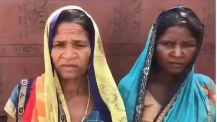 सिंगरौली: महिला ने सास पर जलाने का लगाया आरोप, पीड़िता ने थाने में की शिकायत