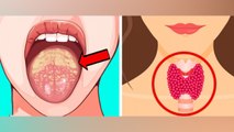 Tonsil Cancer क्या होता है, Bad Breath से लेकर Ear Pain Symptoms ना करें नजरअंदाज | Boldsky