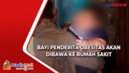 Bayi Penderita Obesitas akan Jalani Perawatan Medis di Rumah Sakit