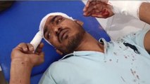 मुरादाबाद:घर से पानी भरने का विरोध करने पर तीन भाइयों ने युवक पर चाकू से किया हमला
