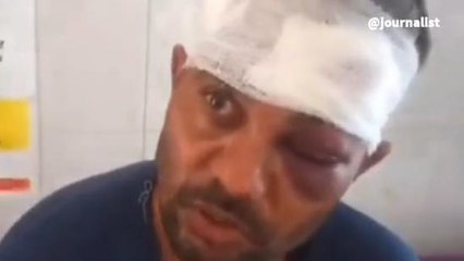 जौनपुर: दो पक्षों के बीच चले ईट पत्थर, 8 घायल, एक्शन में पुलिस