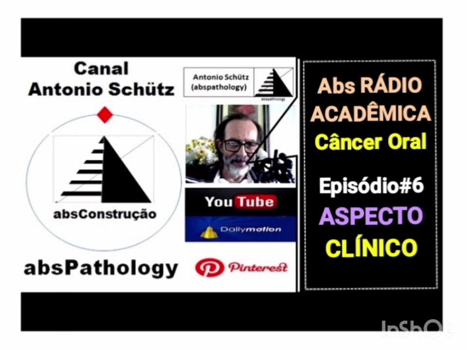 CÂNCER DE BOCA: APARÊNCIA CLÍNICA